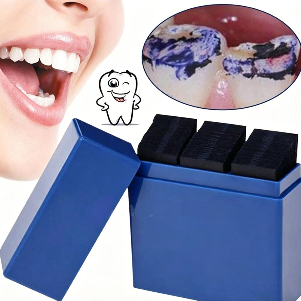 Papel de articular – 300 tiras